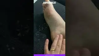 ALIVER Foot Peel Mask Testing | The Results?