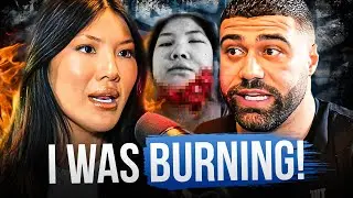HOW I SURVIVED MY FACE BEING SET ON FIRE!! - SOPHIE LEE EP|44
