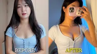 나 가슴수술 안 해도 될 듯ㅋ