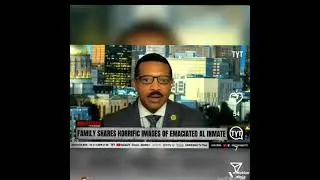 Man 32 held in a elmore county correctional facility in Alabama suffering inhumane treatment
