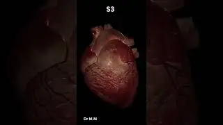 S3 Gallop in 20 Secs! (The Ventricular Squish Sound) #MedEd