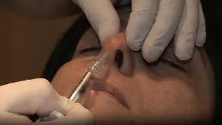 Au secours, je n'aime pas mon nez !