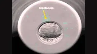 INSTITUT MARQUÈS - Desarrollo de un embrión de ratón visto con el Embryoscope