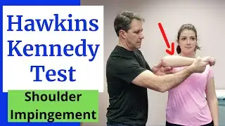 Hawkins Kennedy Test for Subacromial Pain