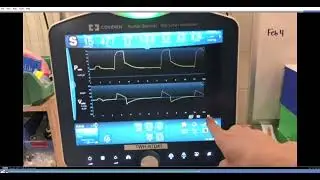 PB980: Measuring P0.1, Pocc, and Delta-P