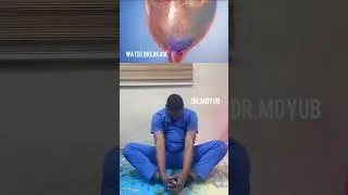 Four butterfly exercises for natural delivery