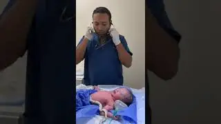 penyelamatan bayi ... masya Allah