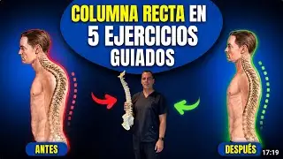5 EJERCICIOS GUIADOS para esta curva llamada [cifosis] la SOLUCIÓN! #cifosis #dolorespalda#joroba 