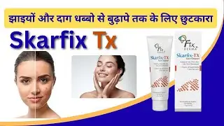 Skarfix TX Cream Review | Skarfix tx cream Reviews in Hindi | Skin Pigmentation Treatment