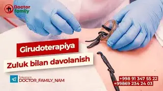 ZULUKLAR YORDAMIDA QAYSI KASALLIKLARNI DAVOLASh MUMKIN?