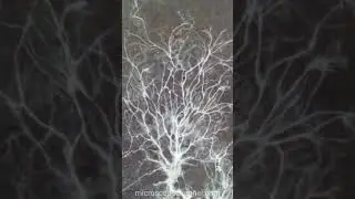 Fungi under a microscope #shorts