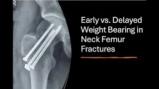 Neck Femur Fractures in Young: Early vs. Delayed Weight Bearing