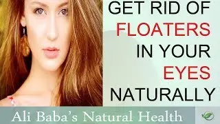 Black Spots In Eyes: How To Cure Floaters In Your Eyes Naturally Fast 2019