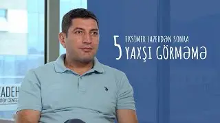 #EksimerLazerdənSonra 5) Yaxşı görməmə