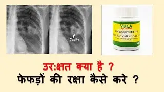 Want to REVERSE Lung Damage? Watch This Now!