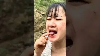 How to Treat a Burned Tongue Quickly #survival #hacks #camping #bushcraft