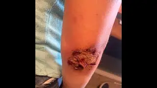 SPFX Makeup How to Create a Scab.