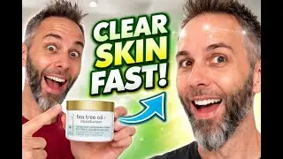 Best Skin Moisturizer for Oily Skin