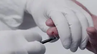 Swelab Alfa Plus capillary sample inlet