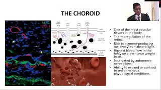 AIOS2025 GP83 T Dr Rupesh AGRAWAL Role of Advanced Image Analysis in Uveitis Diagnosis and Monitorin