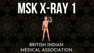 Musculoskeletal Radiology Part 1 - Clinical Crash Course | British Indian Medical Association (BIMA)