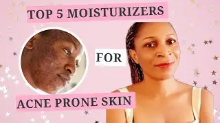 Top 5 Best Face Moisturizers for Oily Skin | Non-Greasy & Lightweight.