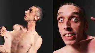 Story of garry turner!  super human in real life.