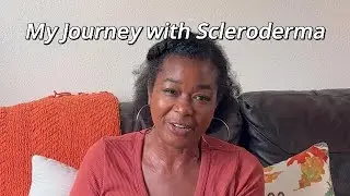 My Journey with Scleroderma (Why I retired early)