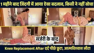 Knee Replacement after 1 महीने बाद सर्जरी ने मरीज की कहानी बदल दी