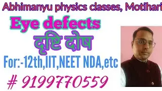 Eye defects( video33)