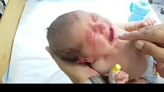 Newborn Baby Started Oral Feeding | Vital Signs Stable | NICU Care Progress