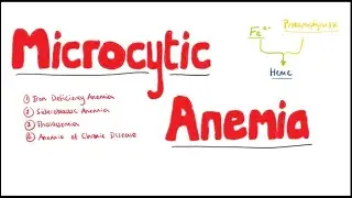 MICROCYTIC ANEMIA : Iron Deficiency Anemia | MEDICALY TEACH
