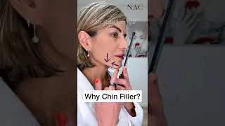 #chinfiller #fillertraining #drbitafarrell