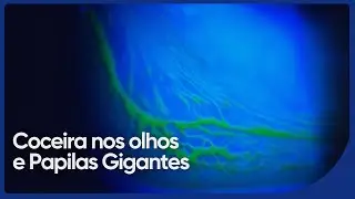 O Que S&atilde;o Essas 