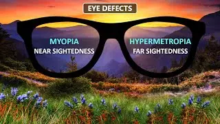 🔍 Defects of Human Eye | Myopia, Hypermetropia & Presbyopia Explained | Class 10 Science Chapter &ndash;