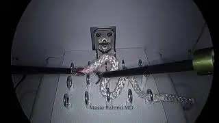 Laparoscopic Advanced Skills: ZigZag Loop