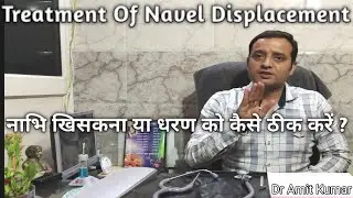 Treatment Of Navel Displacement | नाभि खिसकना या धरण को कैसे ठीक करें ?