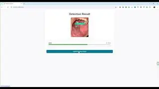 AI-Powered Oral Disease Detection System!