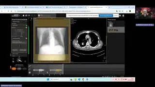 Um apanhado sobre a realização da tomografia computadorizada do tórax - Smart Simulador Siemens