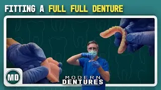 Fitting a Full Upper & Lower Denture (My Complete Process) | Modern Dentures