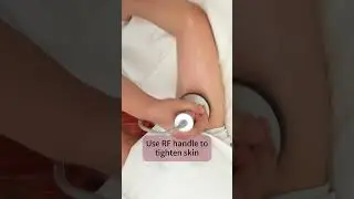 Say Goodbye to Flabby Arms with This Easy RF Skin Treatment! | Model: MS-54D1S8