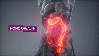 The Importance of Colonoscopy