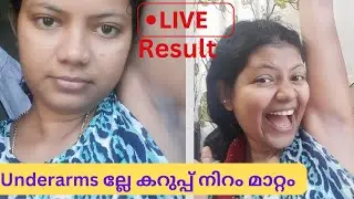 Underarms Darkness Removal | Live Result |malayalam|ഒറ്റ യൂസിൽ തന്നെ result |