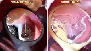 Self-Clean Air Dental Mirror from UK Dentistry,  UHD Front Surface.