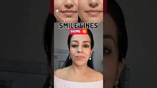 SMILE LINE EXERCISE & MASSAGE | #smileline #beauty #faceyoga #faceexercise #glowup #makeup