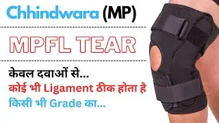 Chhindwara (MP) MPFL Ligament दवाओं से ठीक हुआ की नहीं ??