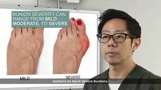 Orthopaedic Surgeon Explains Bunion Surgery Dr Tan Ken Jin Orthopaedics