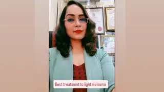 Melasma #chloasma # hyperpigmentation treatment