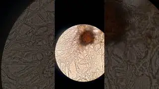 Classical Fungi under Microscope #mycelium #fungus #microbiology