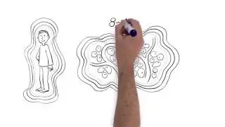 Matrix Rhythm Therapy (MaRhyThe) - EN - Animated Explanation Video